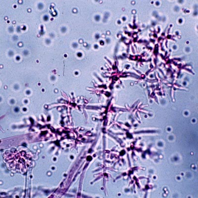 trichoderma2